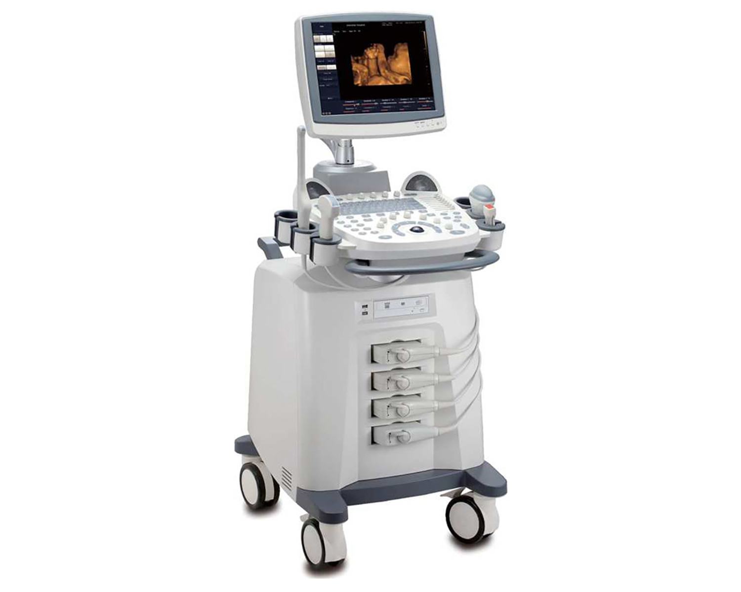 Ultrasound machine at Sigma MRI & Diagnostic Centre in Bareilly